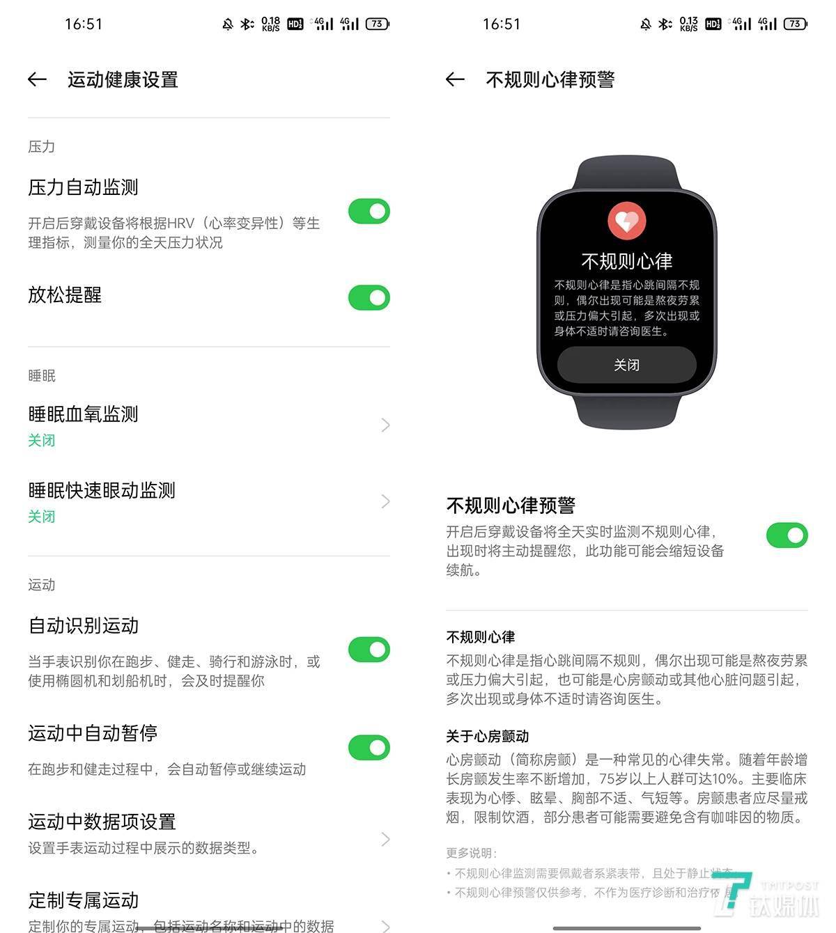 香港正版资料大全年免费公开,详细解答解释落实_watchOS44.319